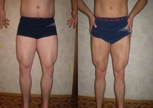 antes e depois de seguir a dieta cetônica